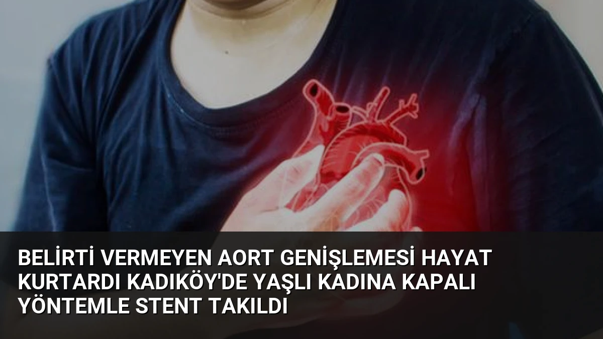 Belirti Vermeyen Aort Genişlemesi Hayat Kurtardı Kadıköy’de Yaşlı Kadına Kapalı Yöntemle Stent Takıldı