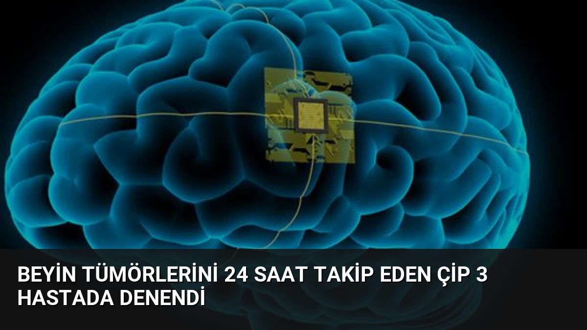 Beyin tümörlerini 24 saat takip eden çip 3 hastada denendi