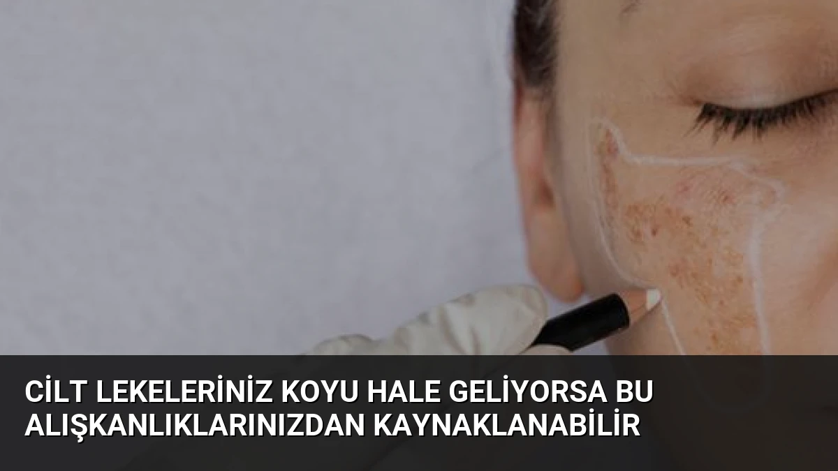 Cilt Lekeleriniz Koyu Hale Geliyorsa Bu Alışkanlıklarınızdan Kaynaklanabilir