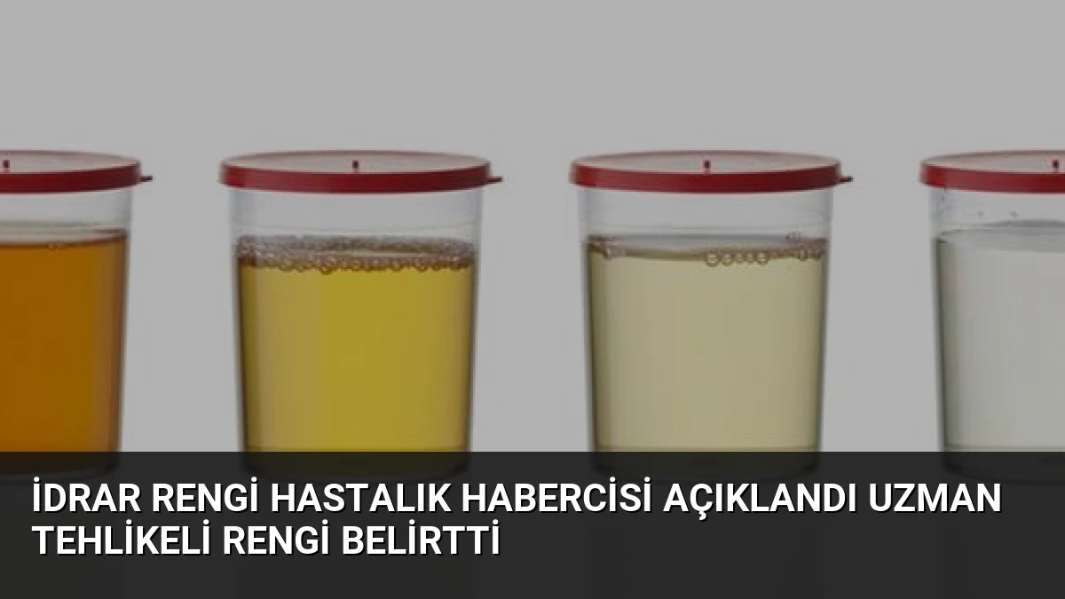 İdrar Rengi Hastalık Habercisi Açıklandı Uzman Tehlikeli Rengi Belirtti