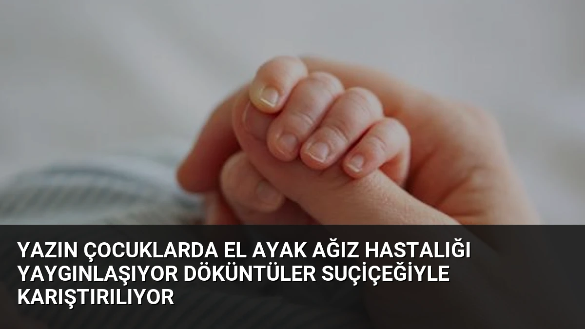Yazın Çocuklarda El Ayak Ağız Hastalığı Yaygınlaşıyor Döküntüler Suçiçeğiyle Karıştırılıyor