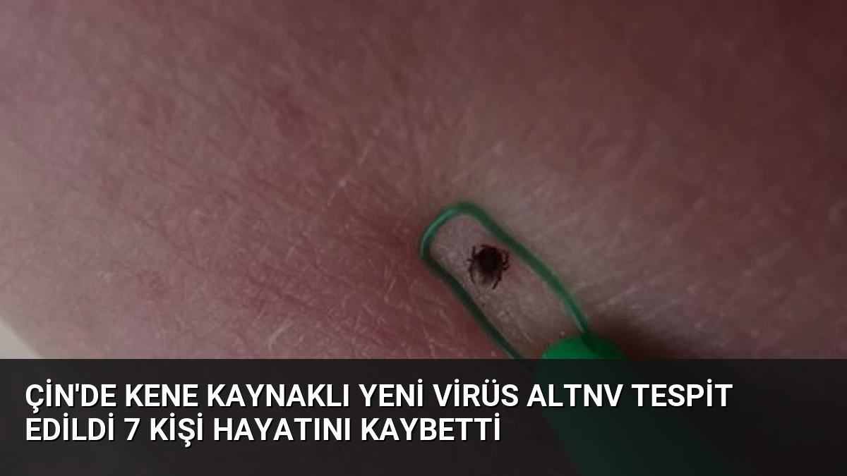 Çin’de Kene Kaynaklı Yeni Virüs ALTNV Tespit Edildi 7 Kişi Hayatını Kaybetti