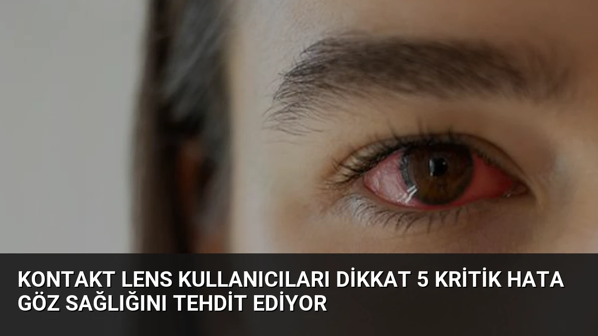 Kontakt Lens Kullanıcıları Dikkat 5 Kritik Hata Göz Sağlığını Tehdit Ediyor