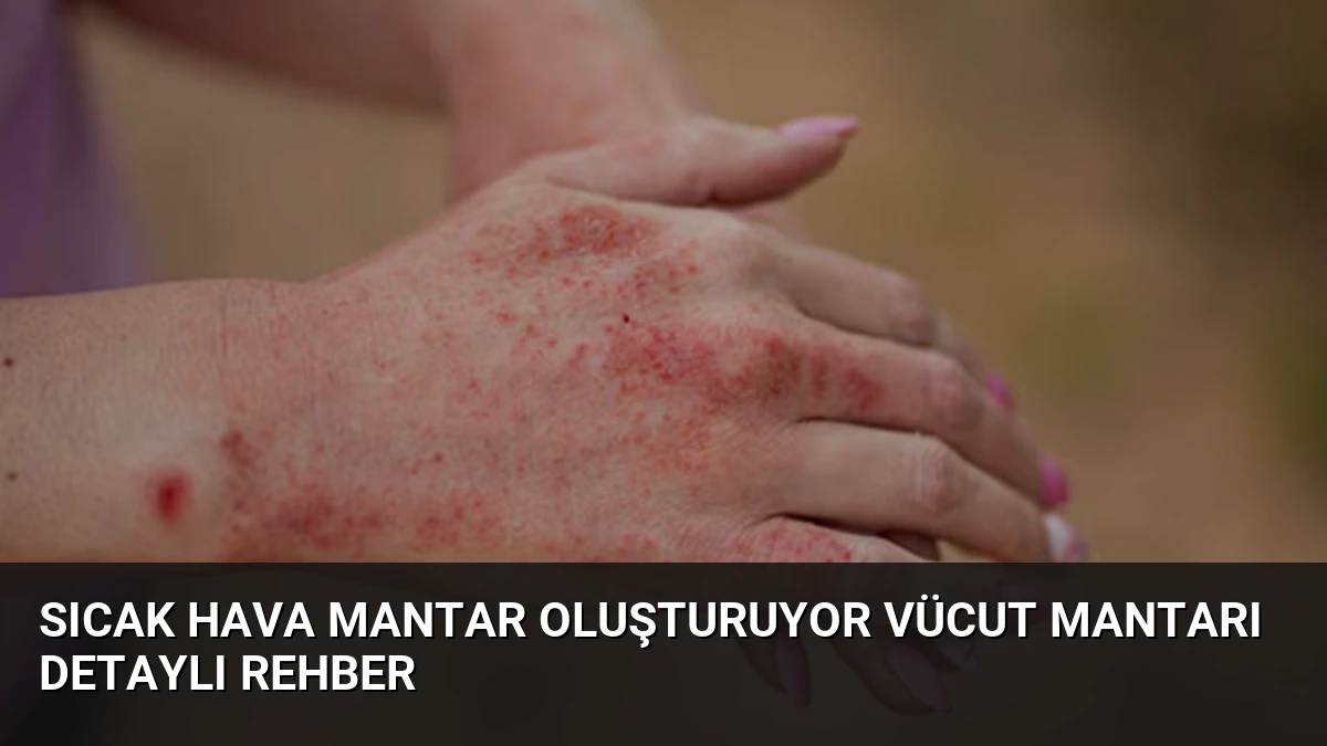 Sıcak Hava Mantar Oluşturuyor Vücut Mantarı Detaylı Rehber